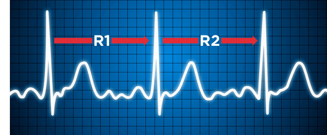 Heartratevariability (HRV)